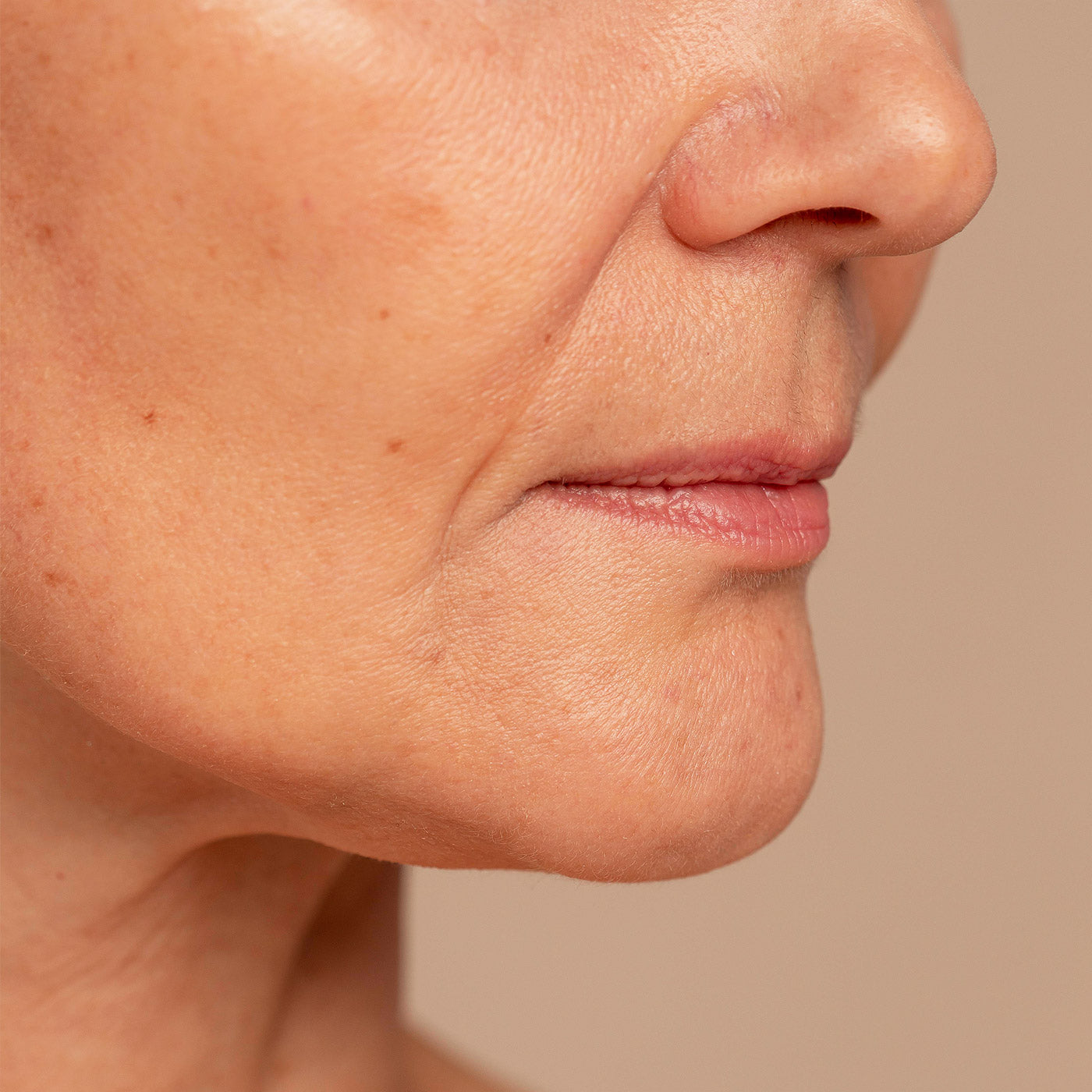 Ultra HIFU 12D: Rejuvenecimiento facial y reafirmación de la piel